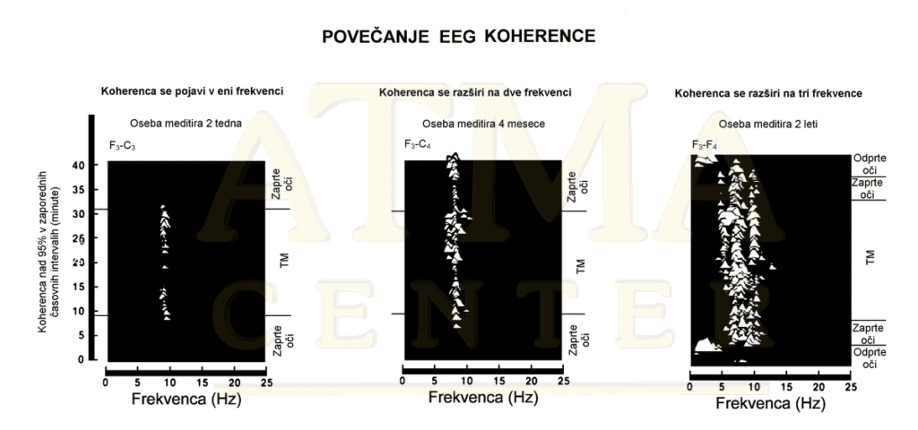 Razvoj visoke EEG koherence z vadbo Transcendentalne meditacije