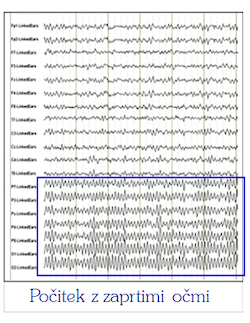 EEG alfa valovi