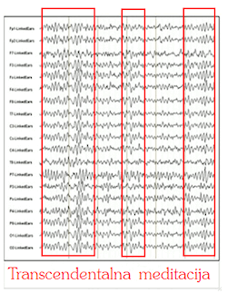 EEG alfa valovi med Transcendentalno meditacijo