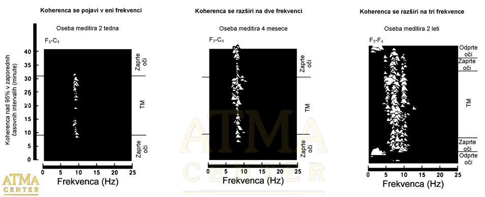 EEG koherenca